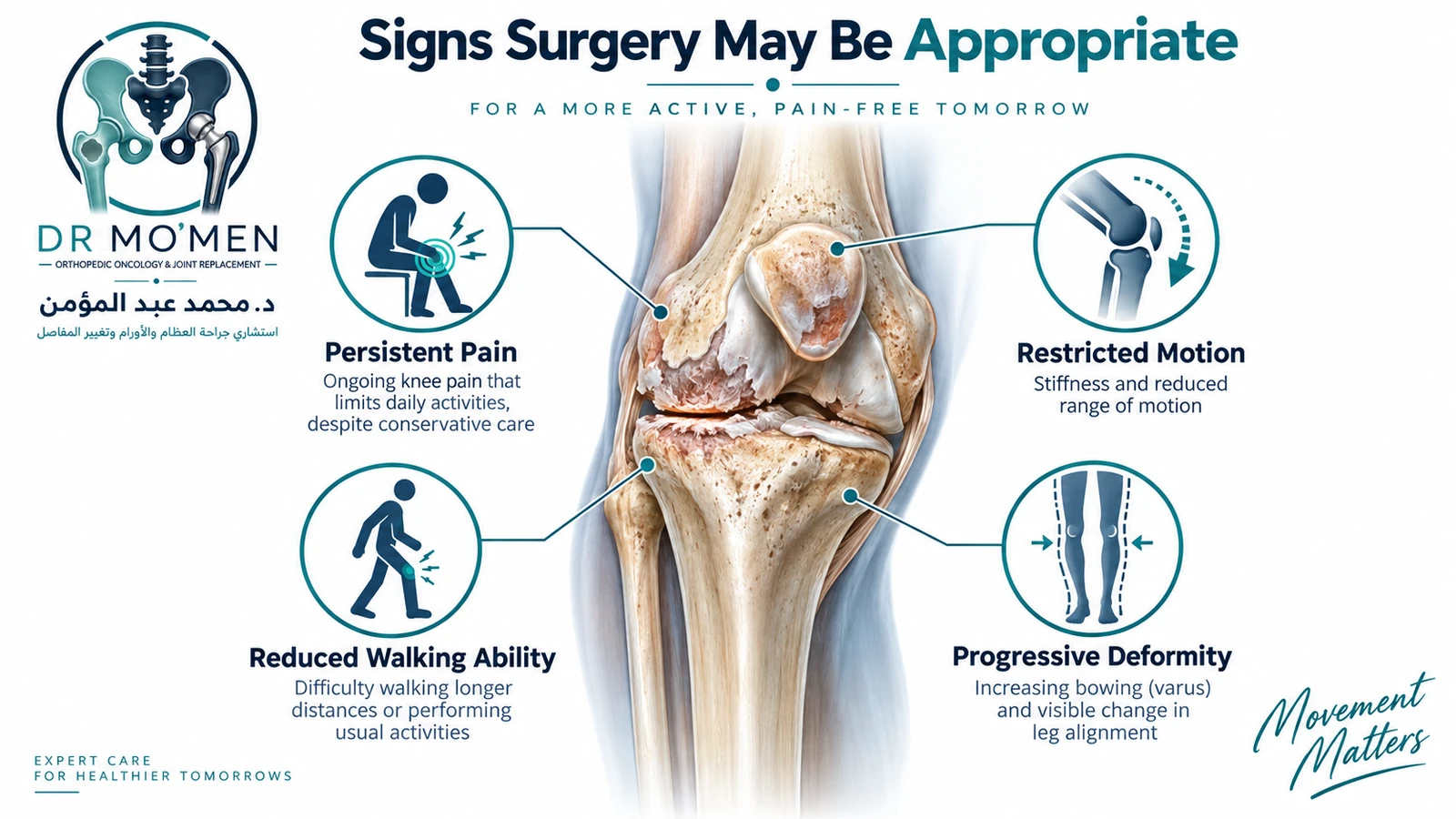Signs Surgery May Be Appropriate Medical illustration showing severe knee arthritis with pain, stiffness, reduced walking ability and progressive deformity.