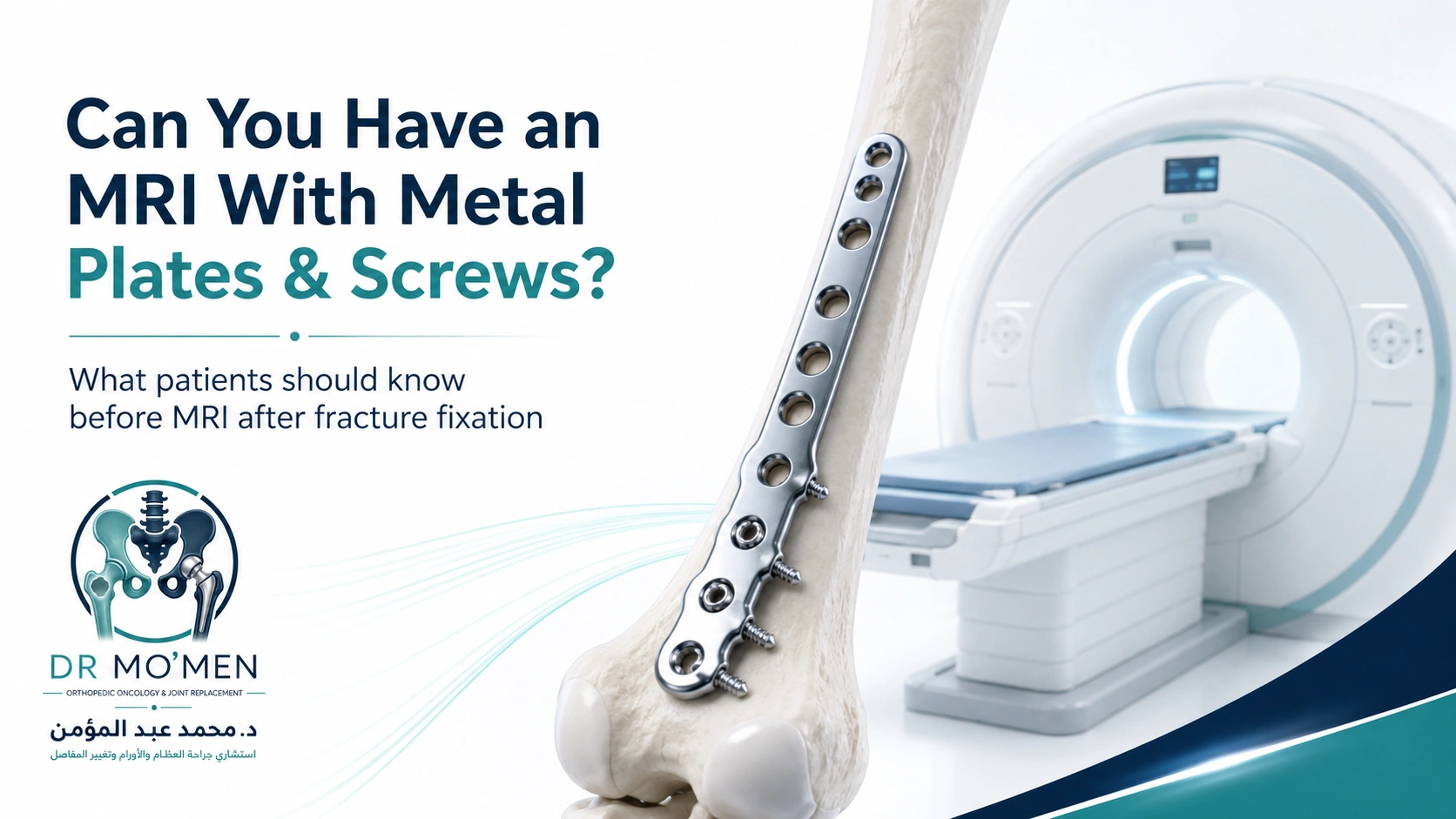 Orthopedic bone plate and screws beside an MRI scanner, illustrating implant safety screening before scanning.