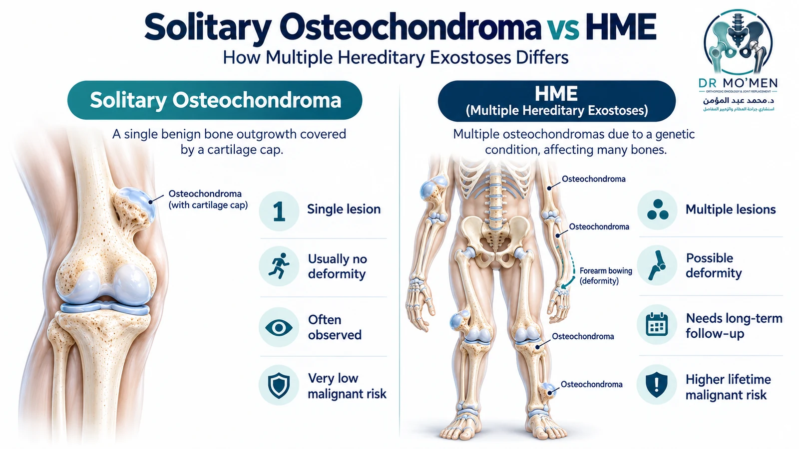Medical comparison of solitary osteochondroma and hereditary multiple osteochondromas with potential limb deformity.