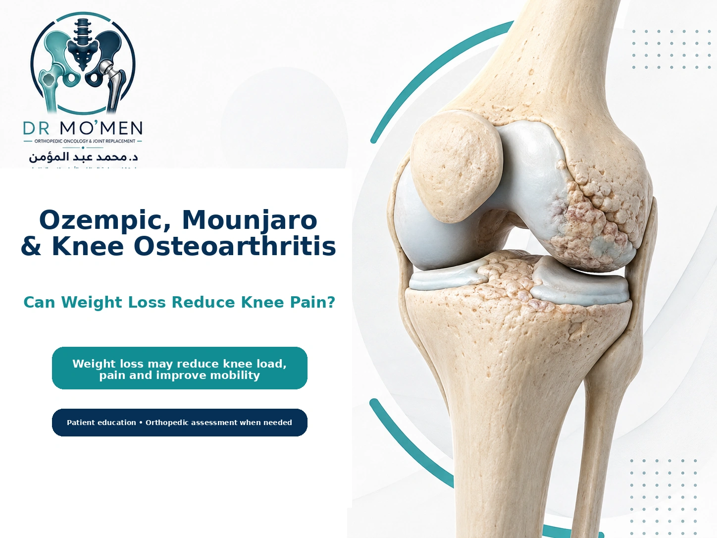 Medical illustration showing weight loss and knee osteoarthritis in a patient using GLP-1 weight management