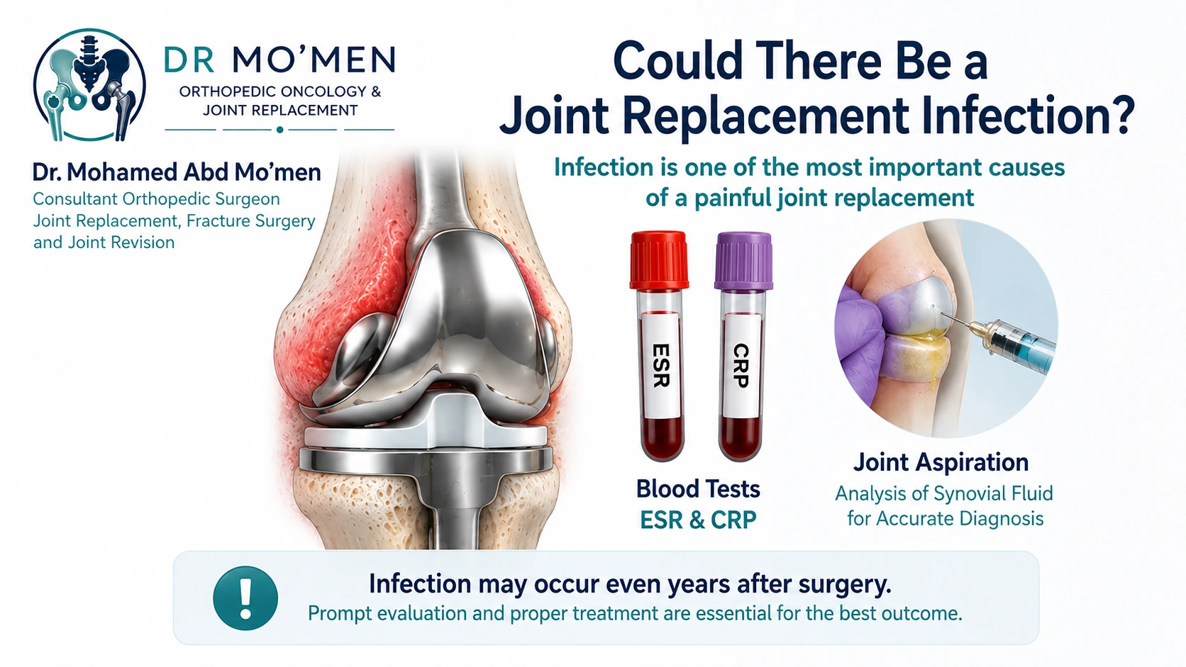 Medical illustration of prosthetic knee infection assessment using ESR, CRP and joint aspiration.