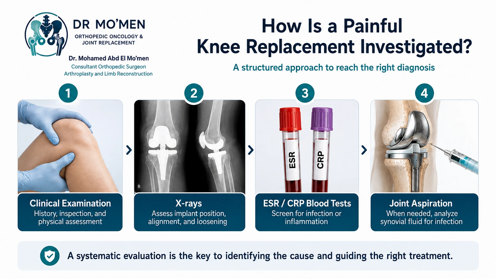 Infographic showing the structured work-up of a painful knee replacement with examination, X-rays, ESR and CRP, and joint aspiration when indicated.