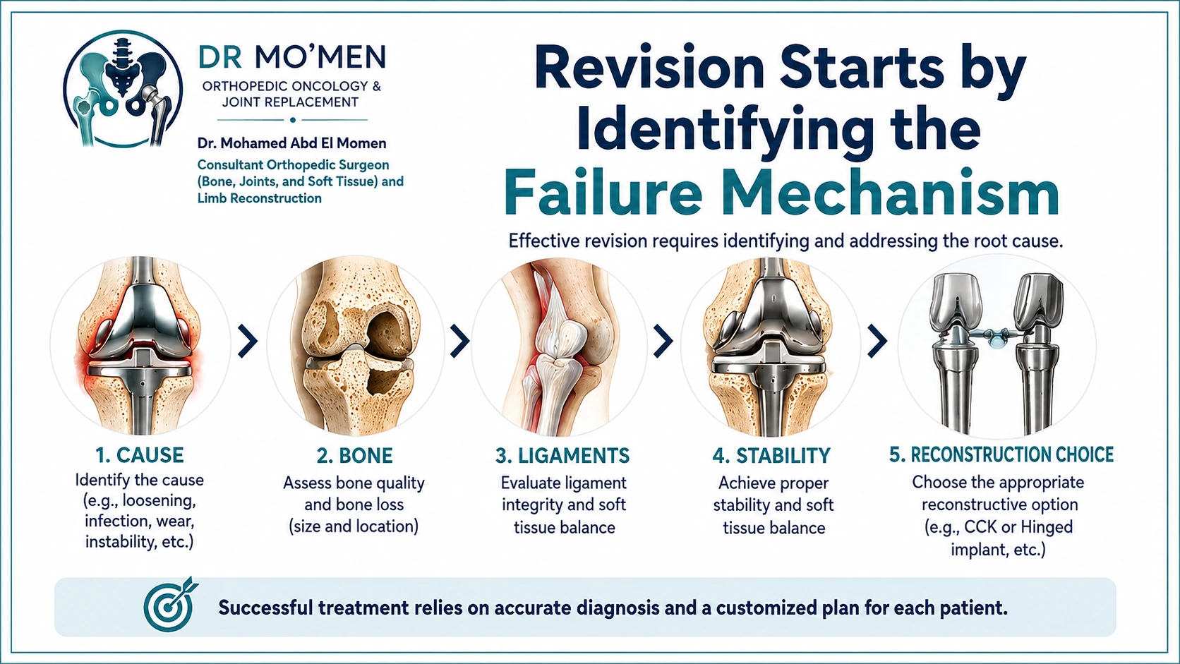 Infographic showing that revision knee surgery starts by identifying the failure mechanism and assessing bone, ligaments and stability before reconstruction.