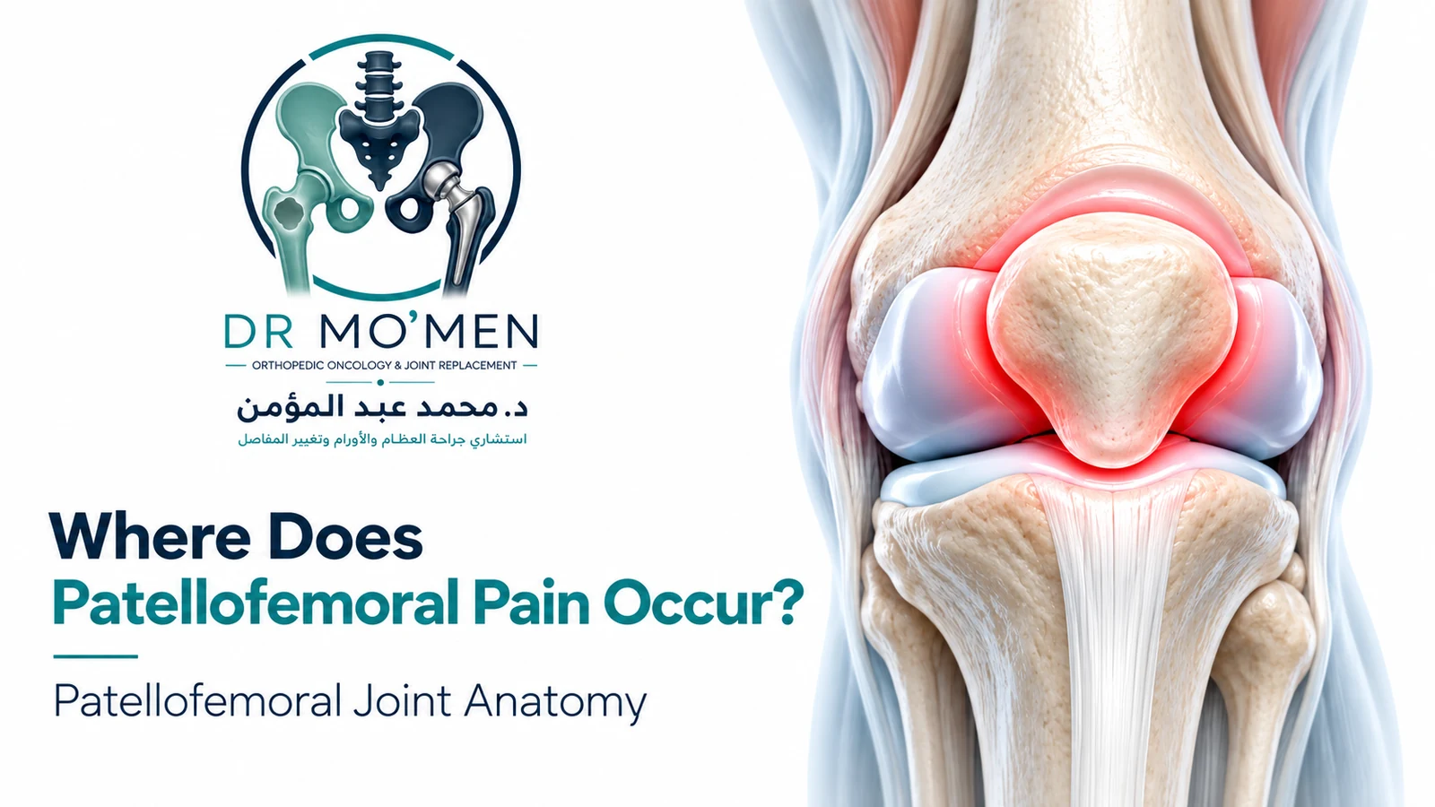 Where Does Patellofemoral Pain Occur? Medical illustration of the patellofemoral joint showing the patella and trochlea.