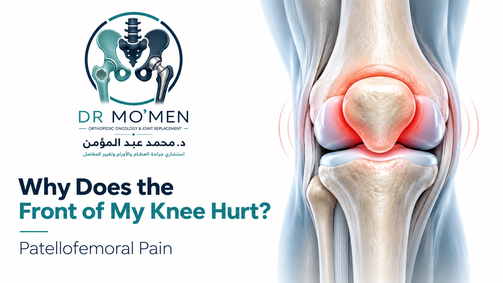 Why Does the Front of My Knee Hurt? Branded medical illustration showing anterior knee pain around the patellofemoral joint.