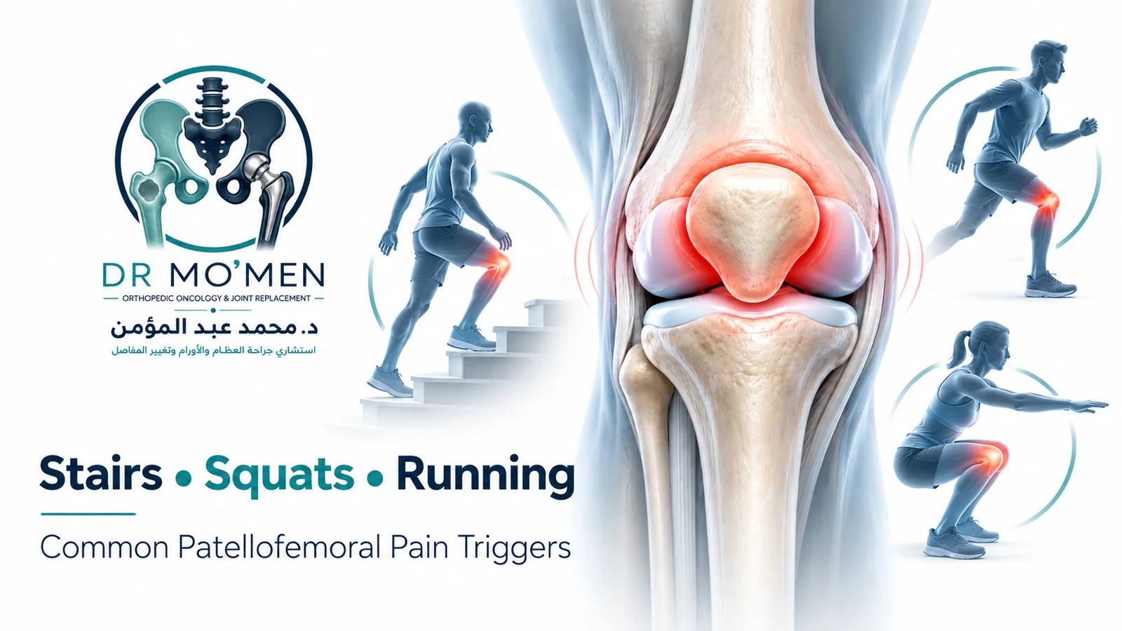 Stairs, Squats and Running Infographic showing stairs, squatting and running as common patellofemoral pain triggers.