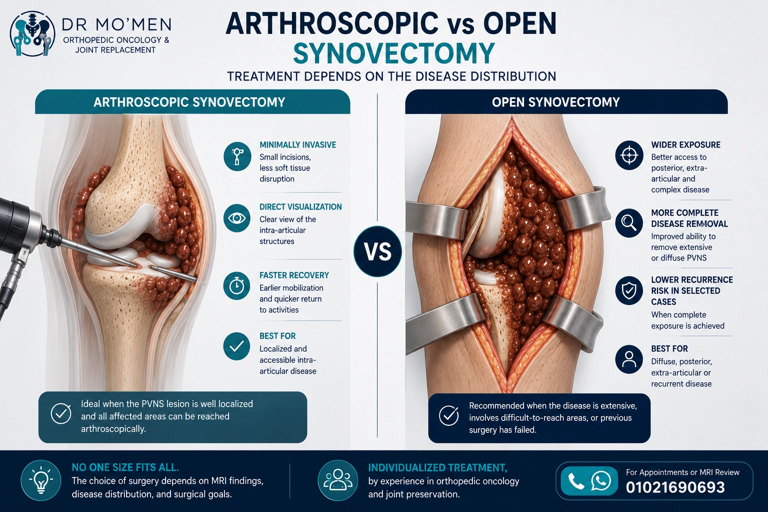 Medical infographic comparing arthroscopic synovectomy with open synovectomy for knee PVNS/TGCT.
