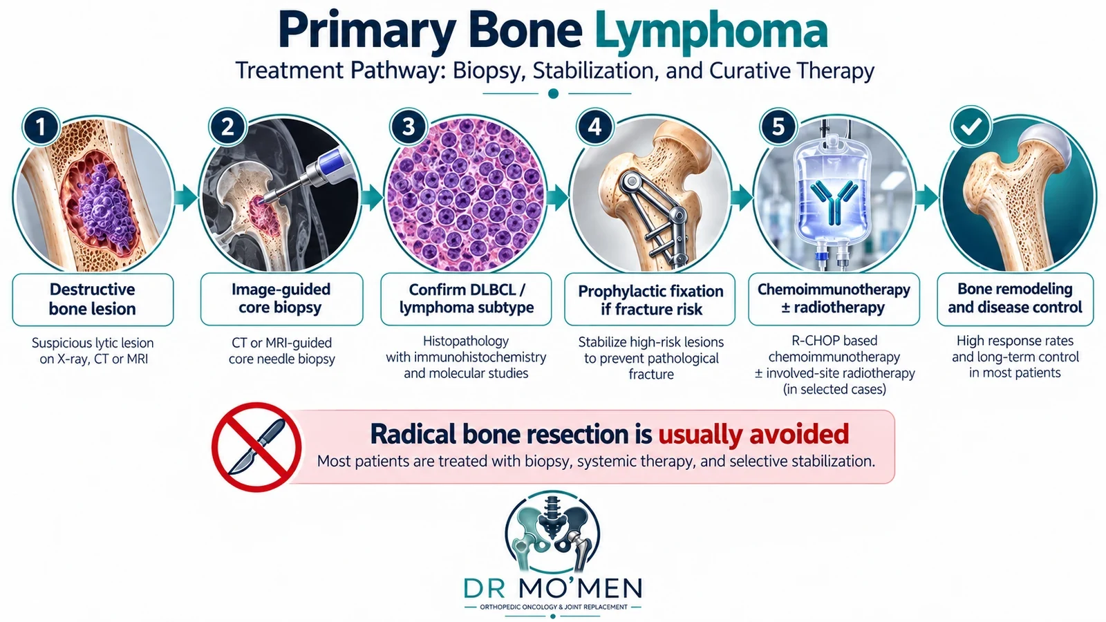 Educational pathway illustrating planned biopsy, individualized stabilization, hematology-led systemic therapy and follow-up.