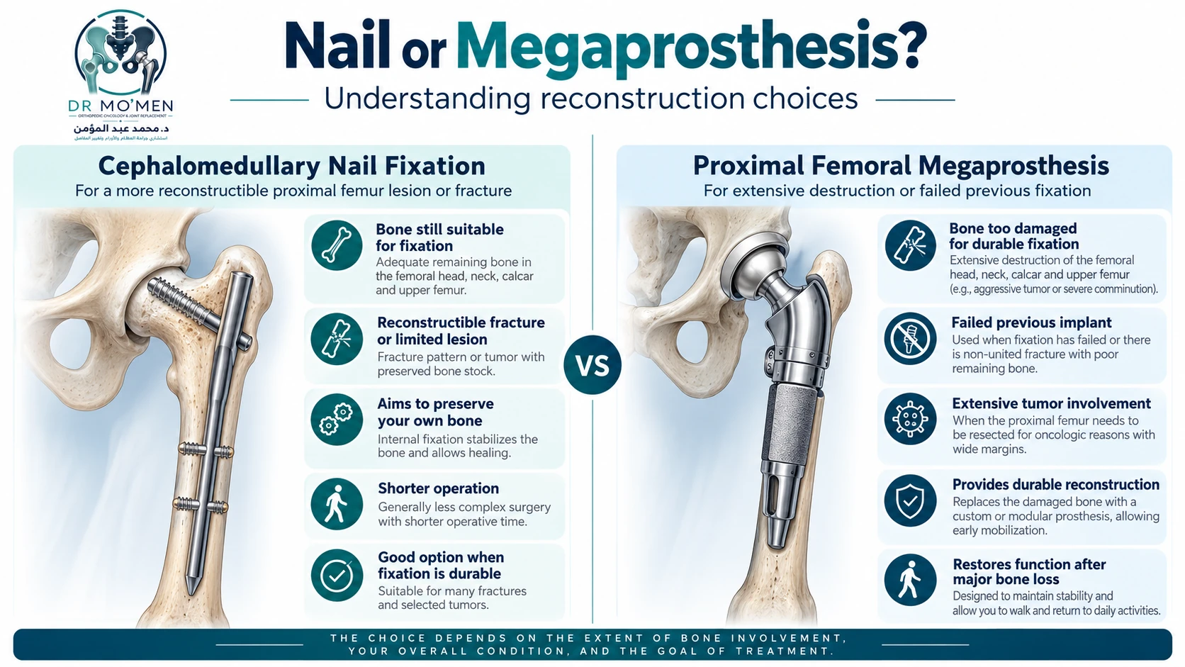 Comparison of cephalomedullary fixation and proximal femoral replacement for reconstructible versus extensive proximal femoral damage.