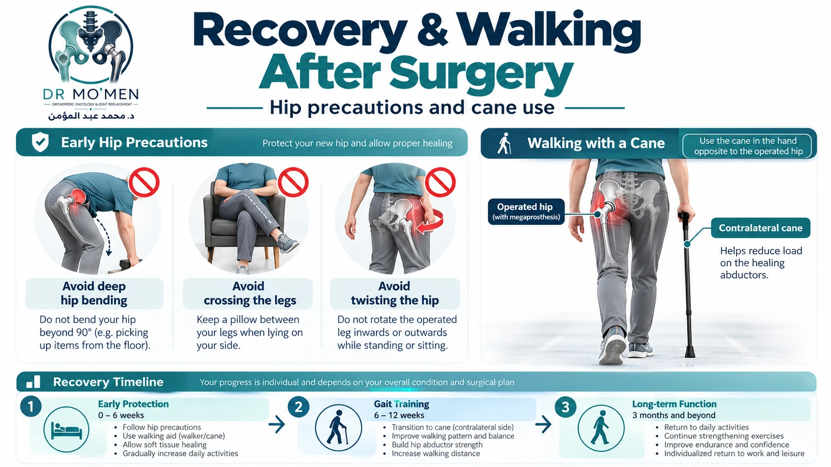 Infographic showing staged recovery, hip precautions and contralateral cane use after proximal femoral megaprosthesis.