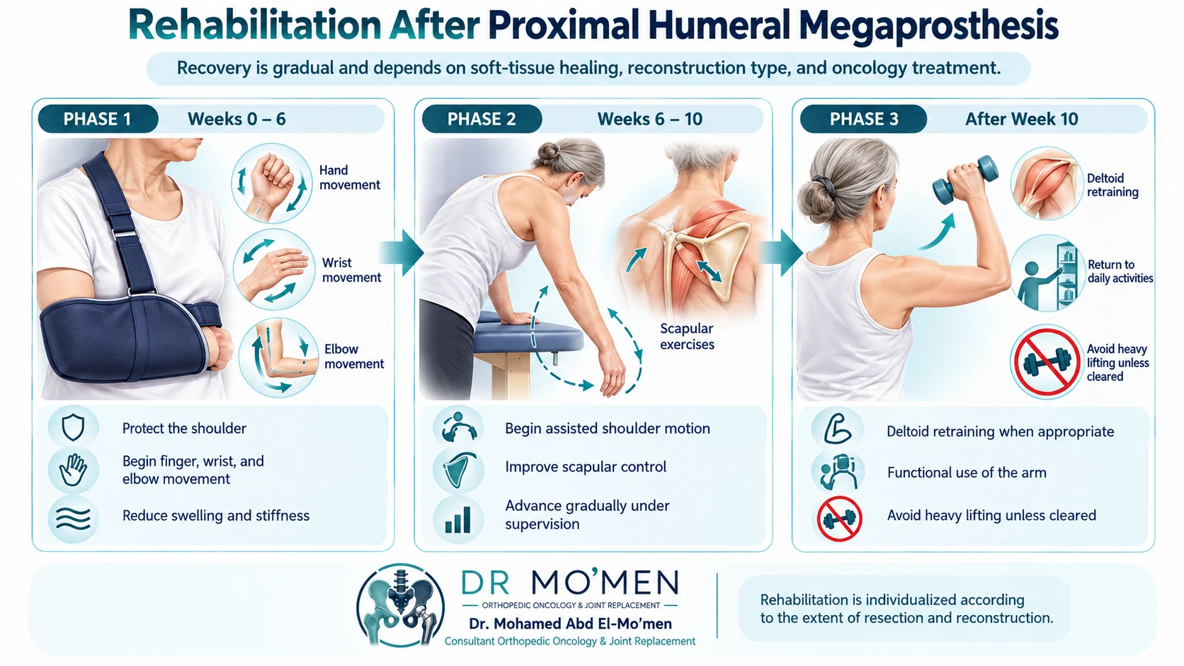 Educational rehabilitation timeline after proximal humeral megaprosthesis surgery showing shoulder protection, distal limb movement, assisted motion and later strengthening.