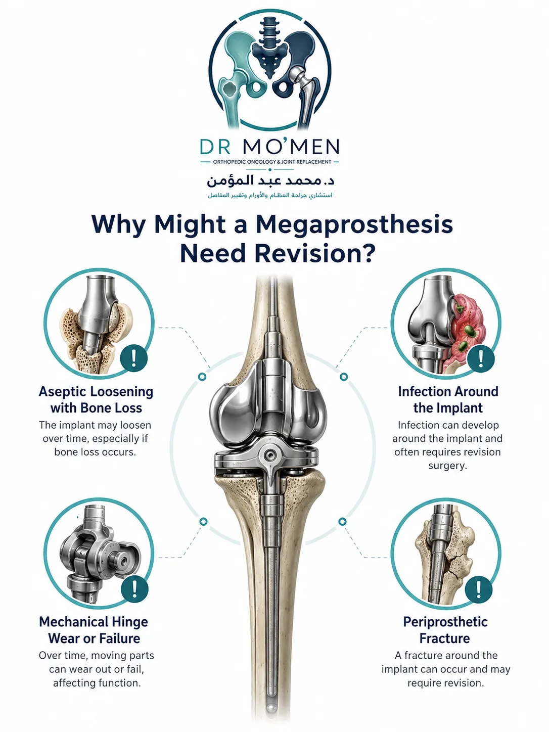 Main reasons a tumor megaprosthesis may require revision including infection loosening fracture and mechanical failure