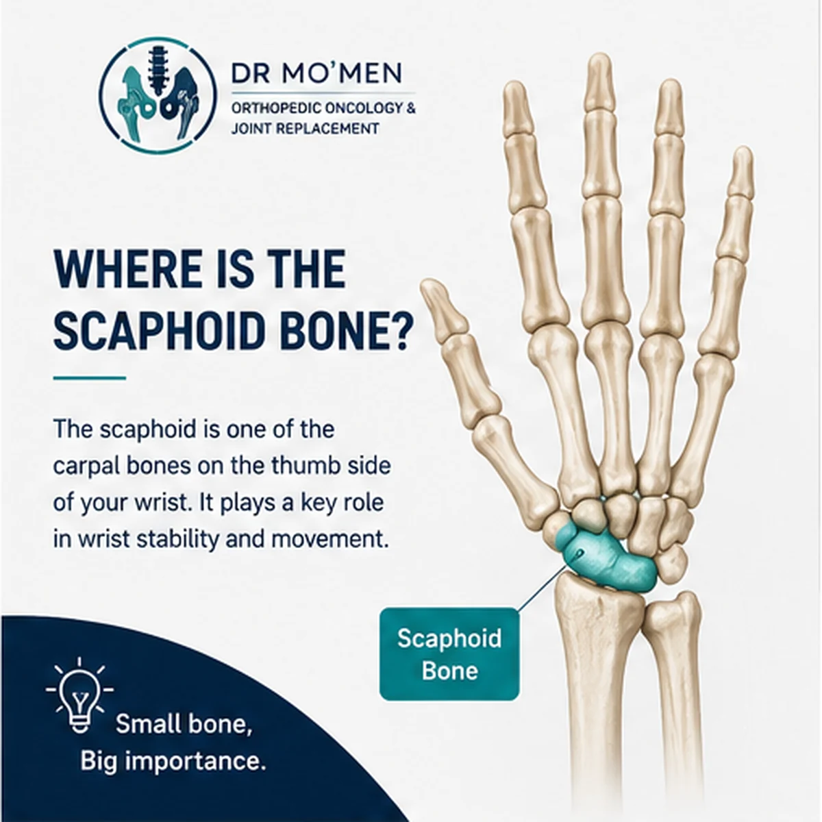 Anatomical illustration showing the scaphoid bone on the thumb side of the wrist