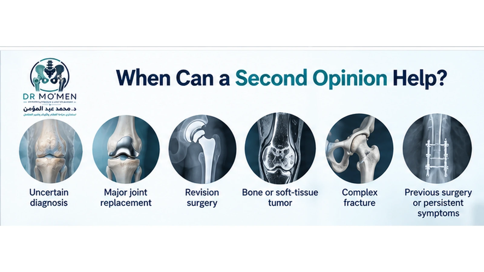When Can a Second Opinion Help? Orthopedic infographic showing major situations where a second opinion may be useful before surgery.