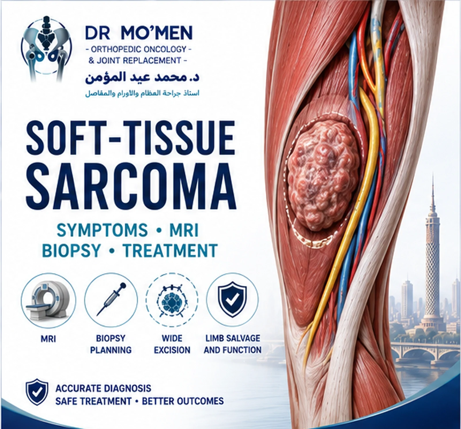 Premium medical illustration showing a deep thigh soft-tissue sarcoma with MRI and planned limb-salvage treatment concepts