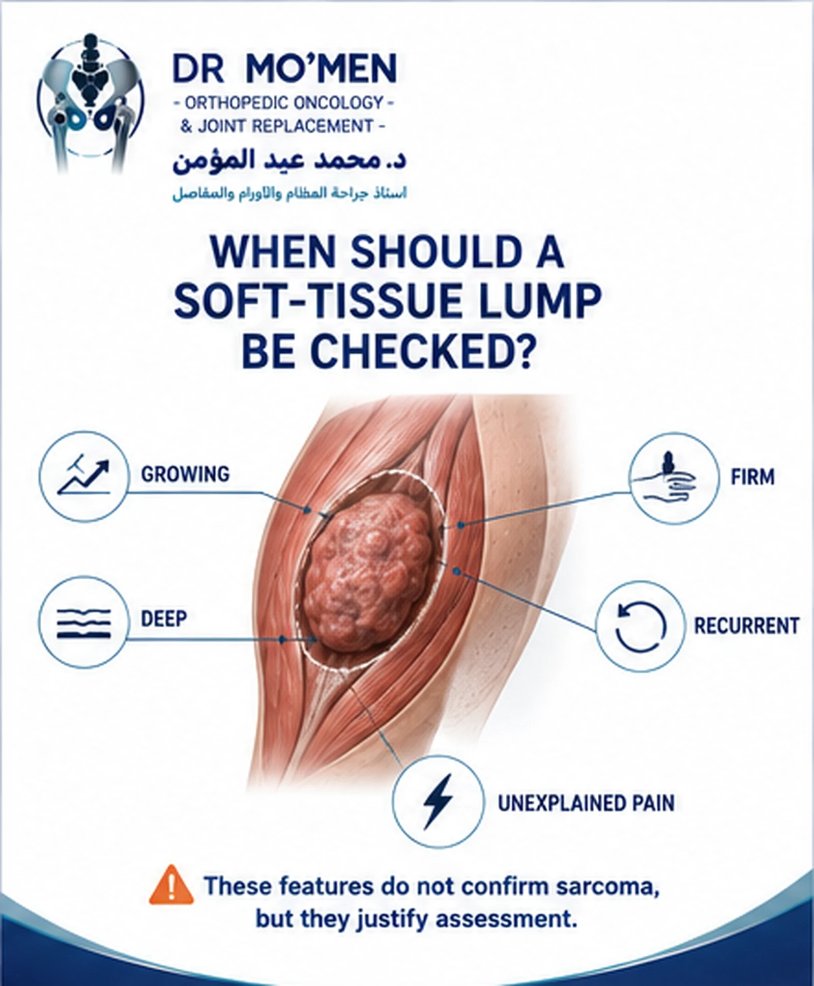 Medical infographic showing warning signs of a suspicious soft-tissue mass