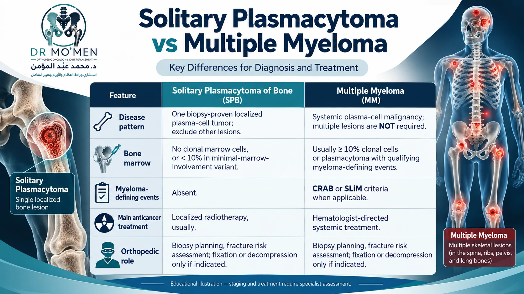 Diagnostic comparison infographic: solitary bone plasmacytoma versus multiple myeloma, including marrow, SLiM-CRAB criteria and treatment.