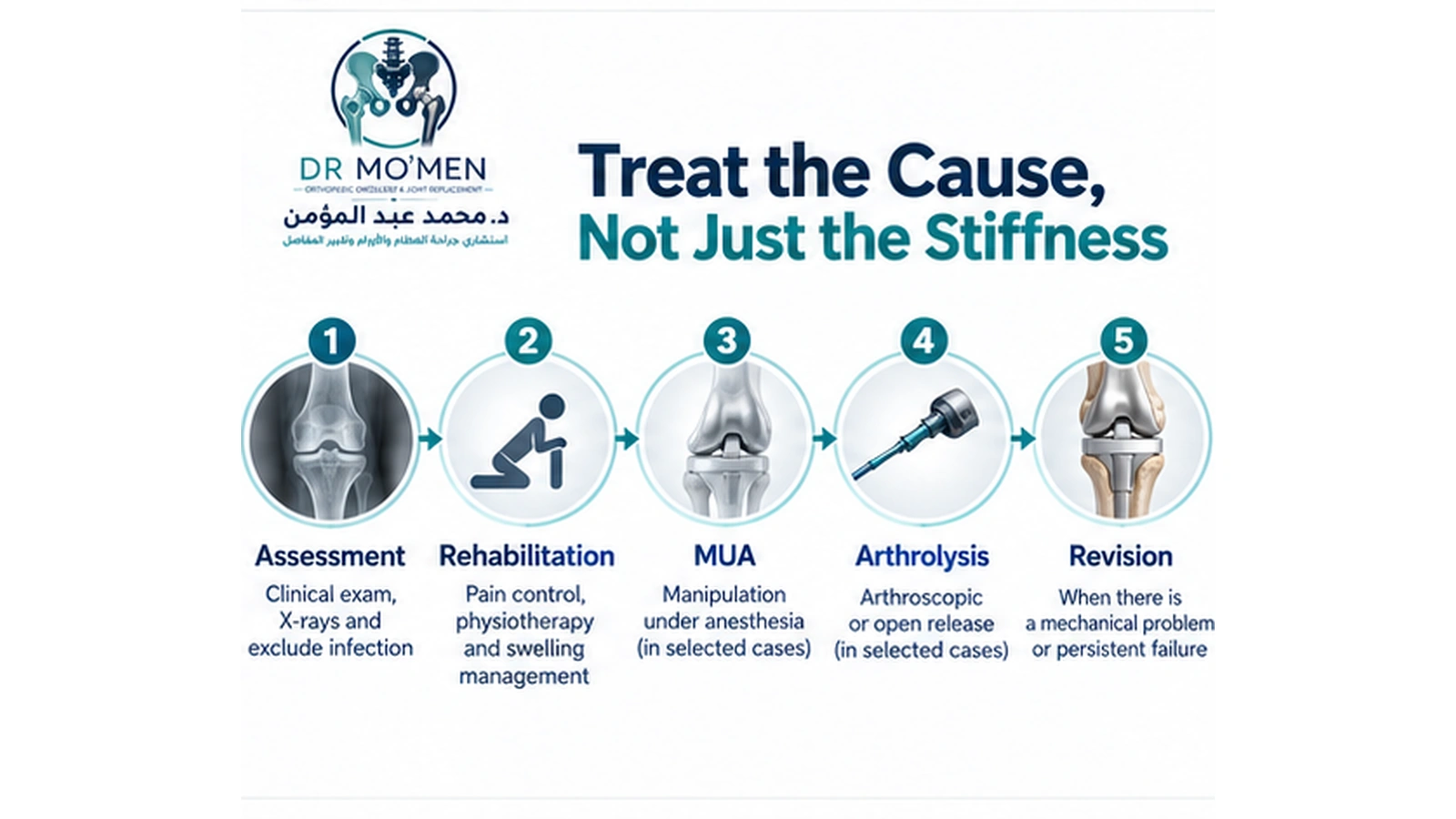 Treat the Cause, Not Just the Stiffness Infographic showing a staged treatment pathway for stiffness after knee replacement.