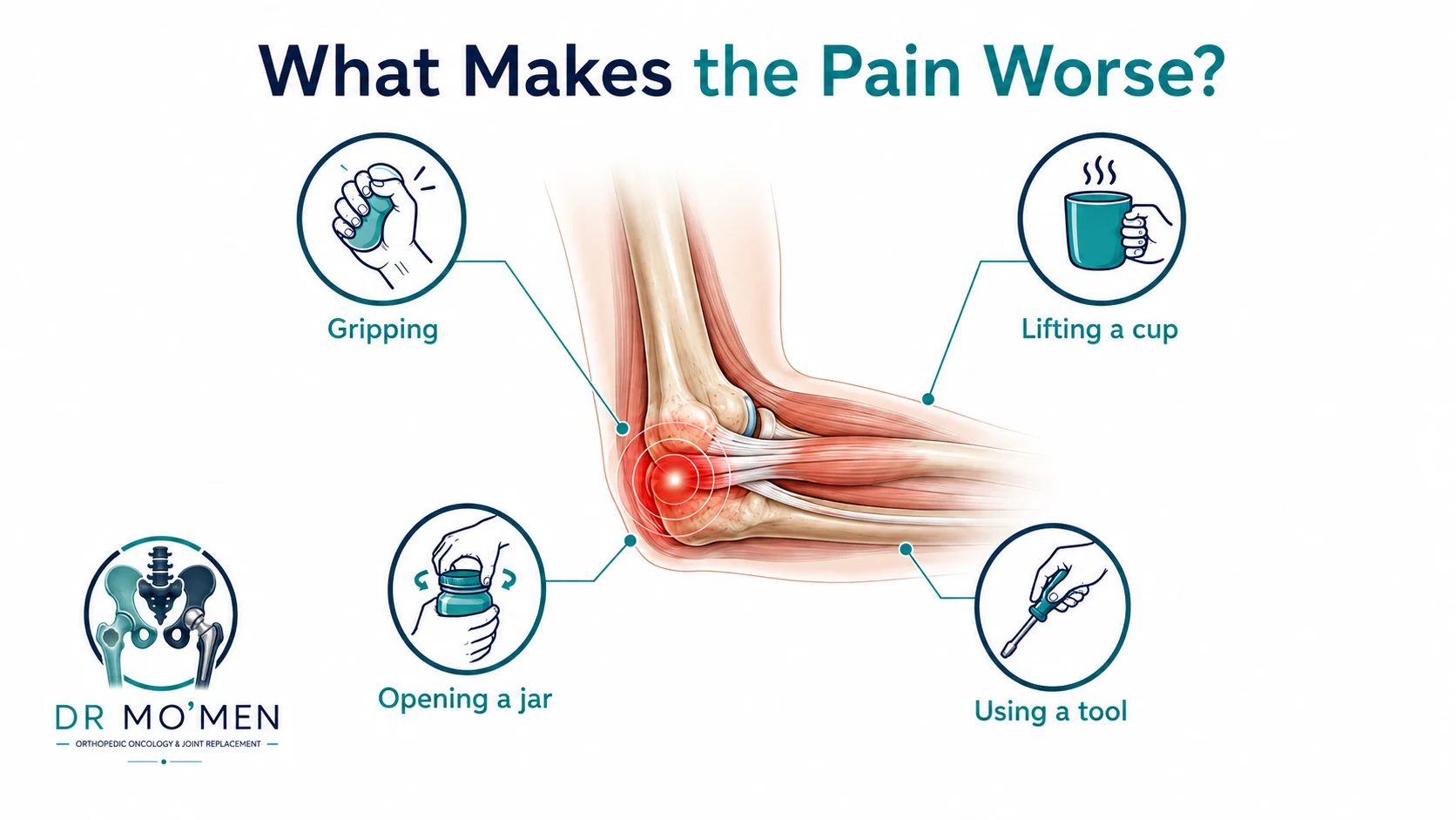 Infographic showing common tennis elbow pain triggers including gripping, lifting a cup, opening a jar and using a tool.