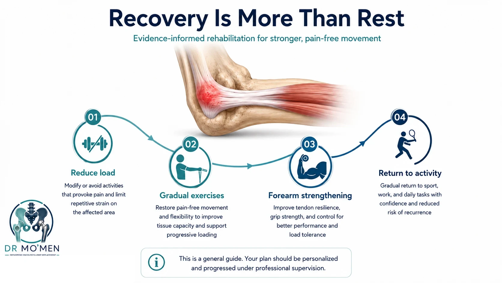 Tennis elbow rehabilitation infographic showing load reduction, gradual exercises, forearm strengthening and return to activity.