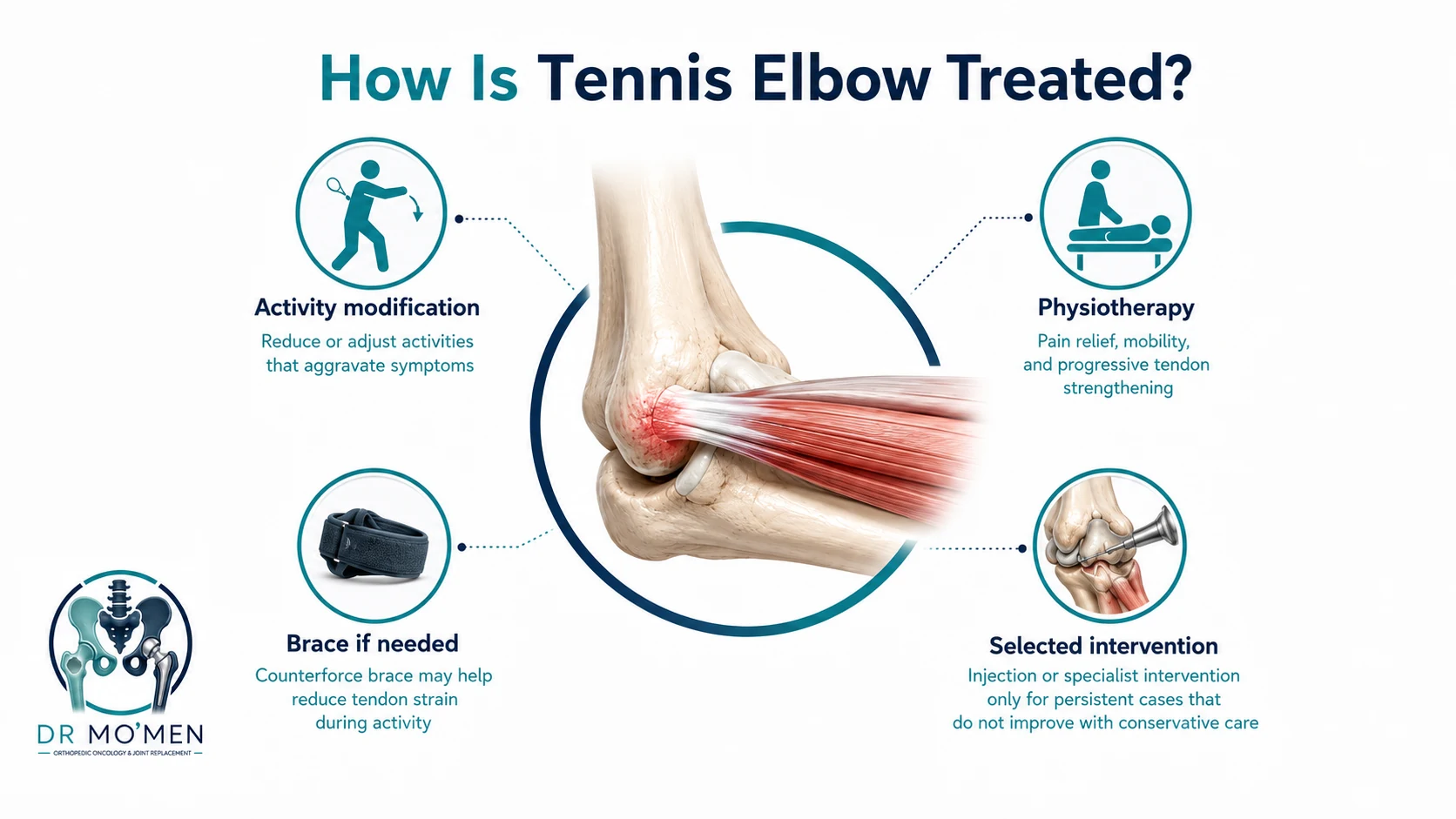 Treatment infographic showing activity modification, physiotherapy, bracing and selected specialist intervention for tennis elbow.