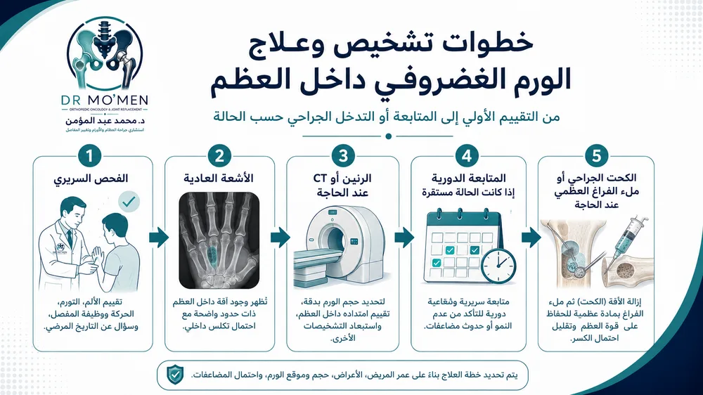 خطوات علاج Enchondroma — من الأشعة إلى كحت الورم وملء الفراغ