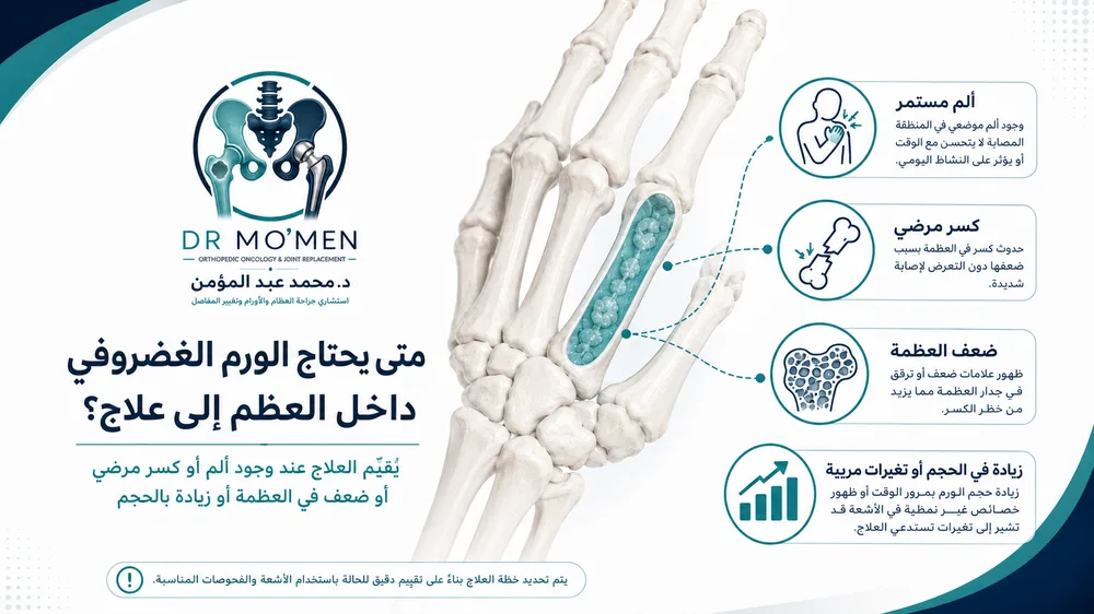 متى يحتاج الورم الغضروفي داخل العظم إلى جراحة — الكسر المرضي في اليد