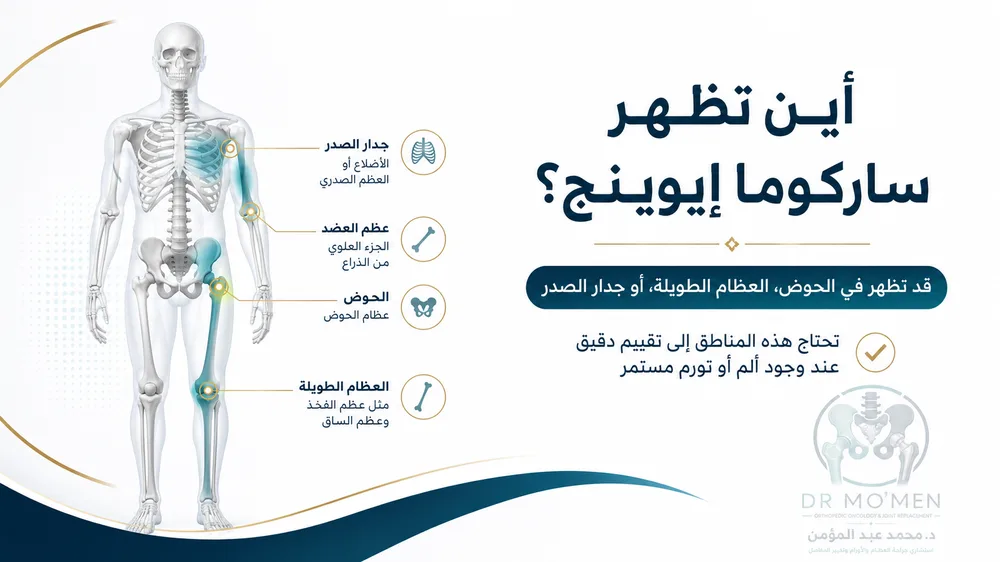 ساركوما إيوينج في العظام — صورة توضيحية داخل المقال رقم 2