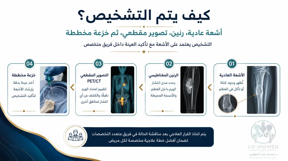 ساركوما إيوينج في العظام — صورة توضيحية داخل المقال رقم 3