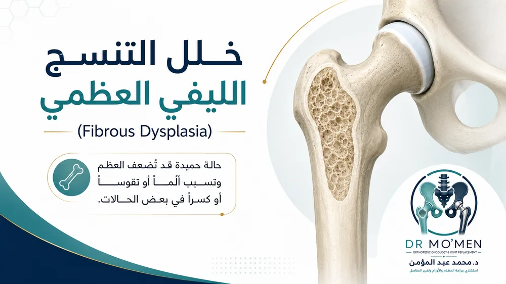 خلل التنسج الليفي العظمي Fibrous Dysplasia — صورة توضيحية داخل المقال رقم 1