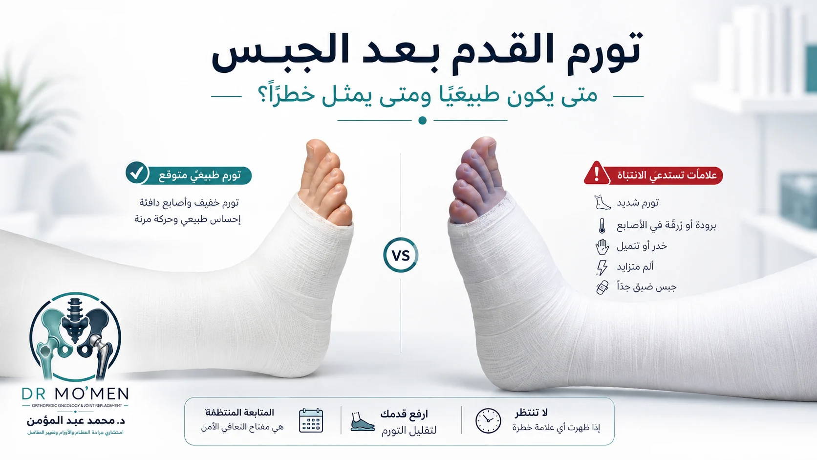 صورة توضيحية تقارن بين التورم الطبيعي المتوقع بعد الجبس والتورم المصحوب بعلامات خطر مثل الزرقة والتنميل والألم المتزايد