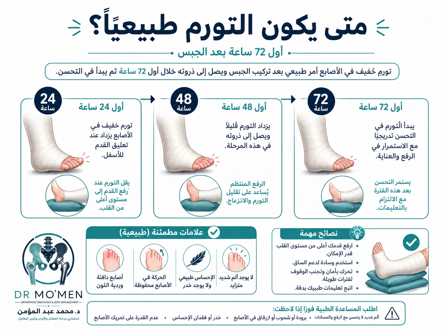 إنفوجرافيك يوضح تطور التورم المتوقع خلال أول 24 و48 و72 ساعة بعد تركيب الجبس مع العلامات المطمئنة