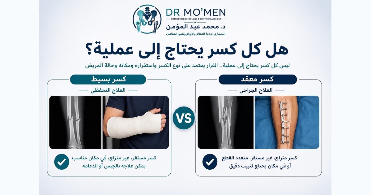 هل كل كسر يحتاج إلى عملية؟ ومتى يمكن علاجه بدون جراحة؟