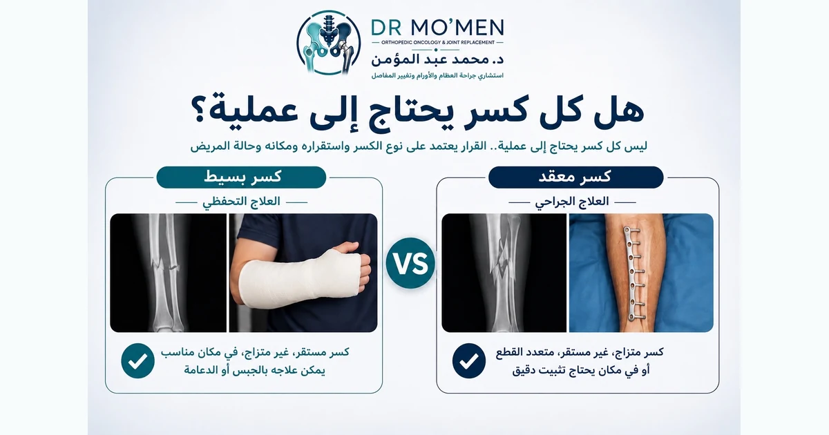هل كل كسر يحتاج إلى عملية؟ ومتى يمكن علاجه بدون جراحة؟