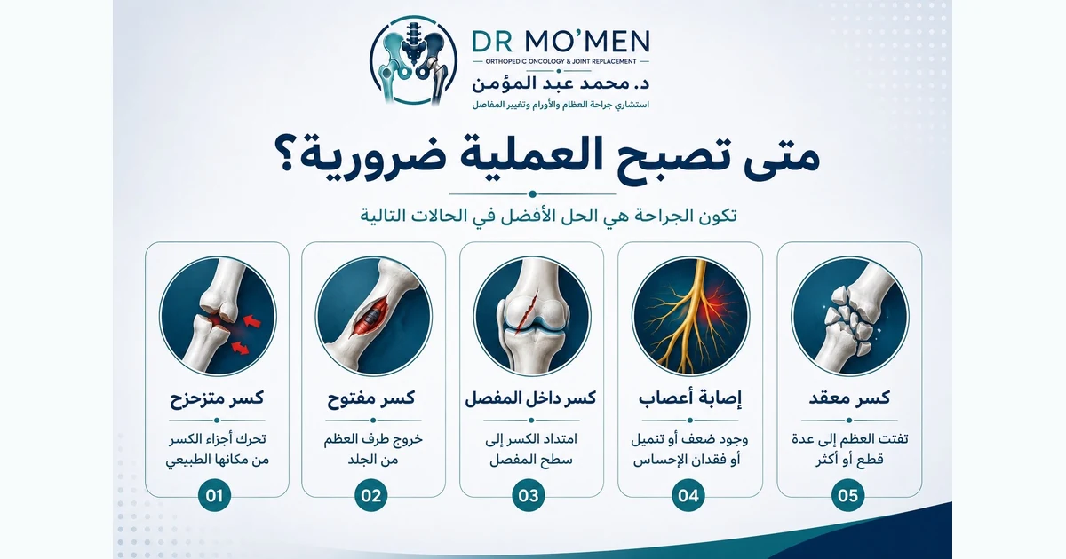 متى تصبح عملية تثبيت الكسر ضرورية في علاج الكسور؟