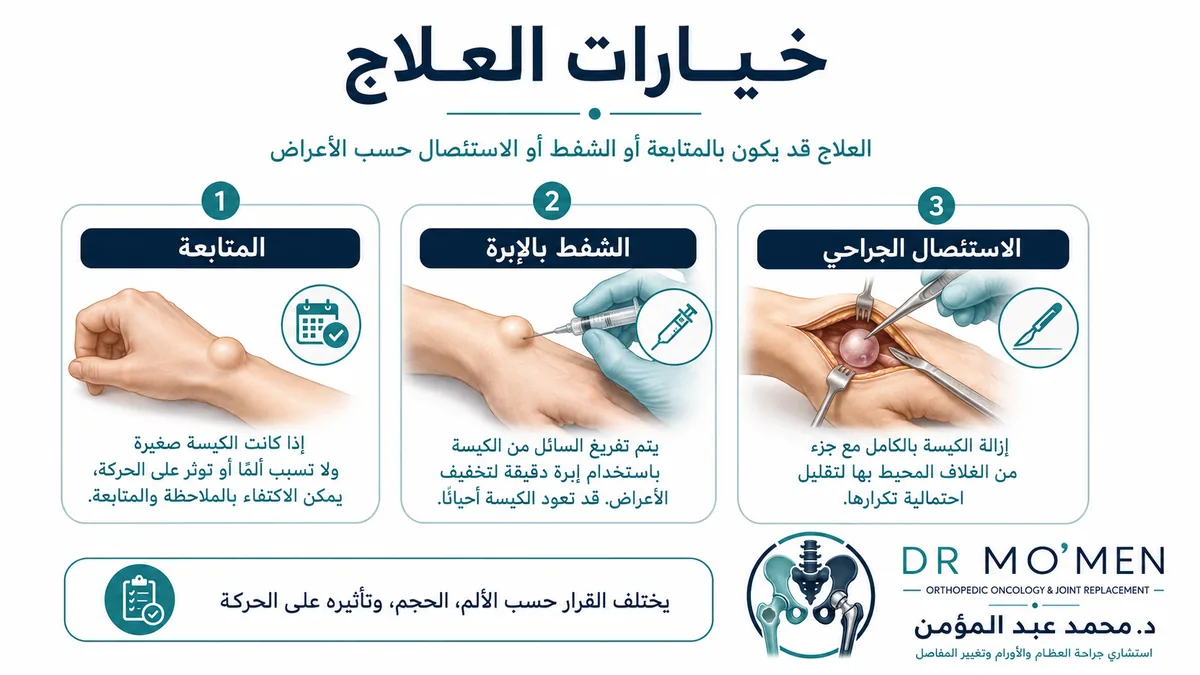 علاج الكيس الزلالي بين المتابعة والشفط والجراحة