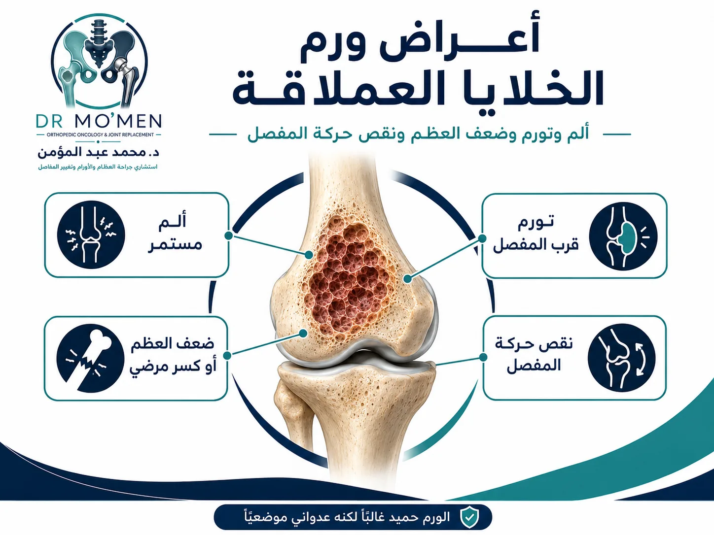 أعراض ورم الخلايا العملاقة مثل الألم والتورم وضعف العظم والكسر المرضي