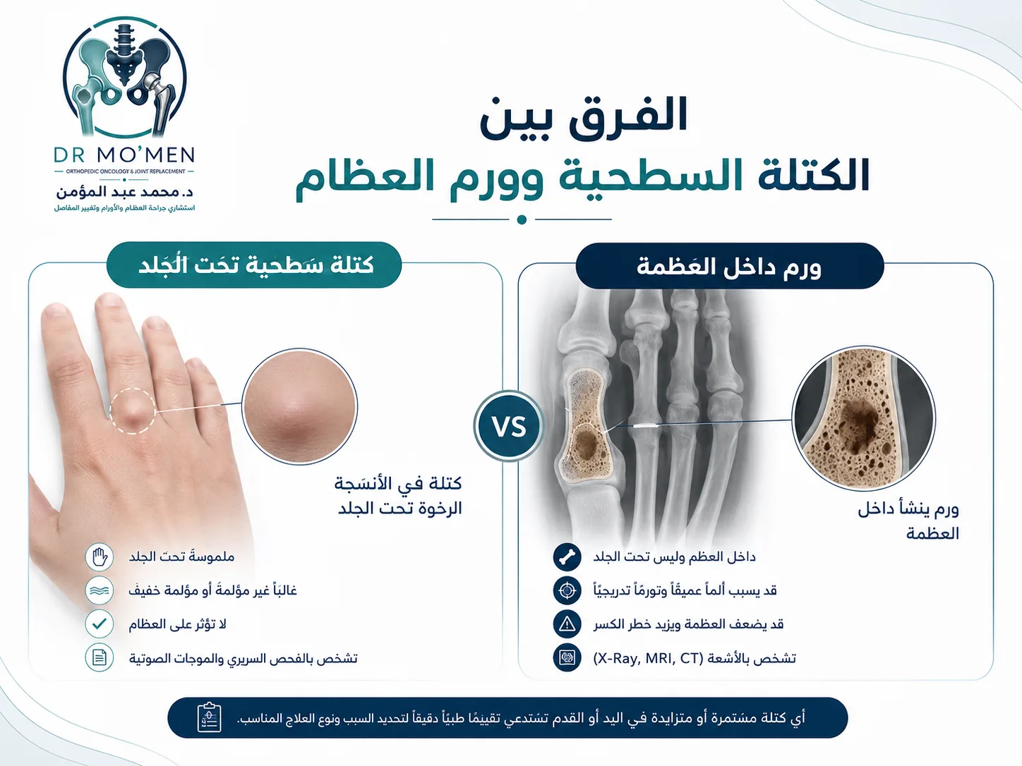الفرق بين الكتلة السطحية وورم العظام داخل عظام اليد والقدم