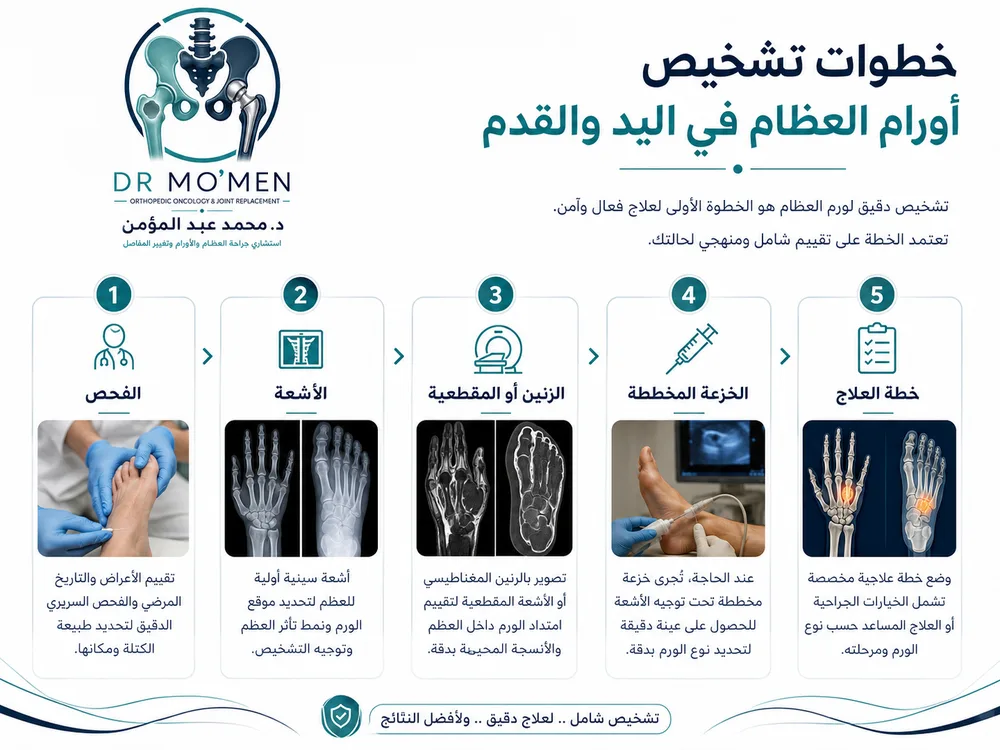 علاج أورام اليد والقدم بين الكحت والتطعيم العظمي والتثبيت