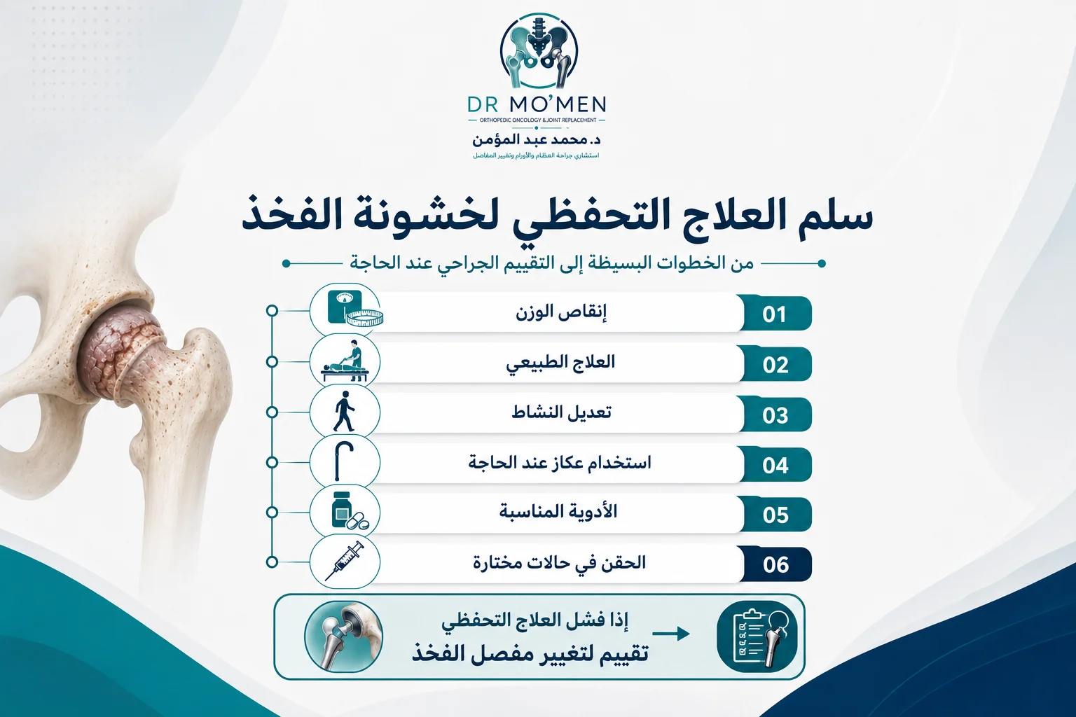سلم علاج خشونة مفصل الفخذ بدون جراحة من العلاج الطبيعي إلى الحقن