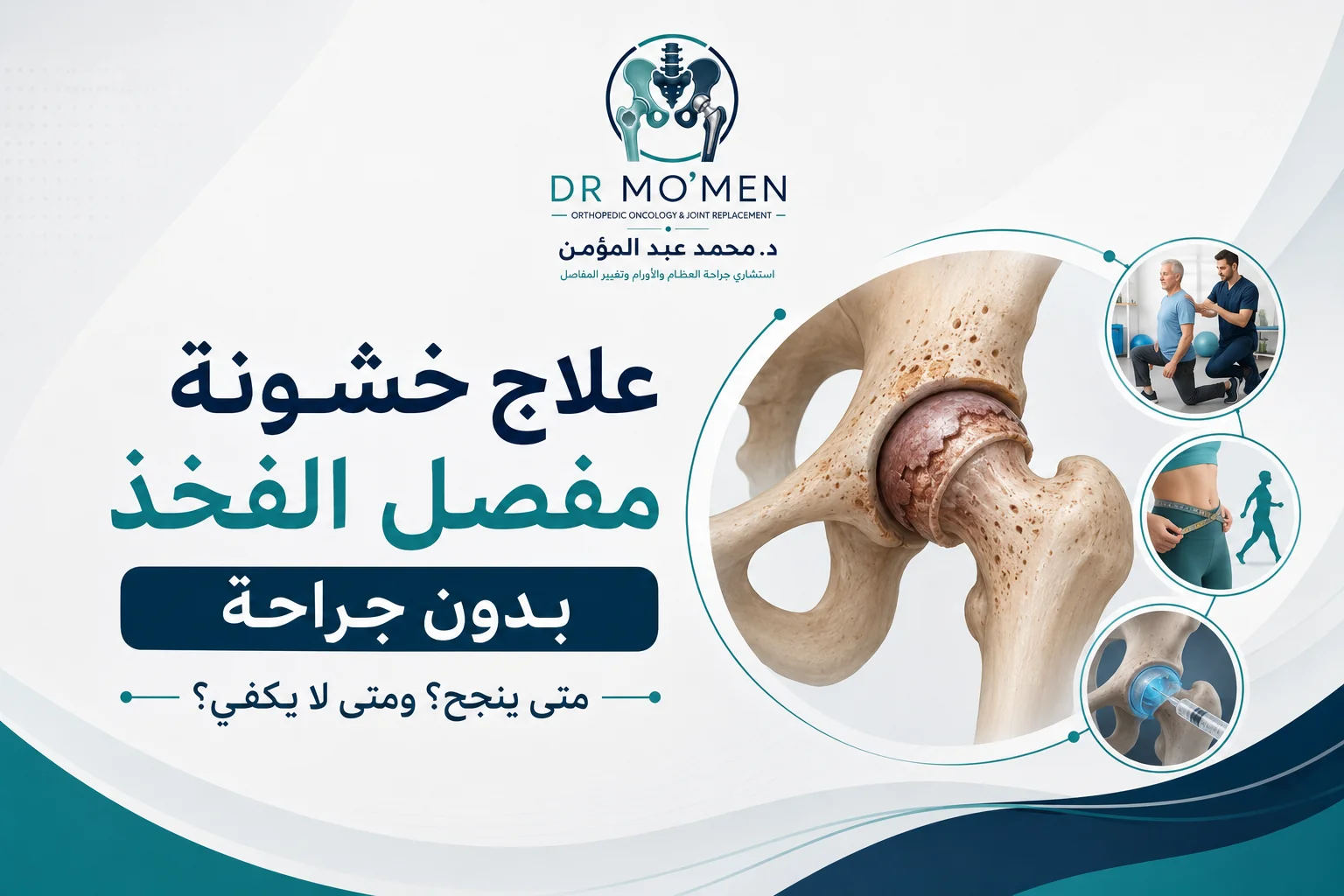 علاج خشونة مفصل الفخذ بدون جراحة ومتى ينجح العلاج الطبيعي والحقن