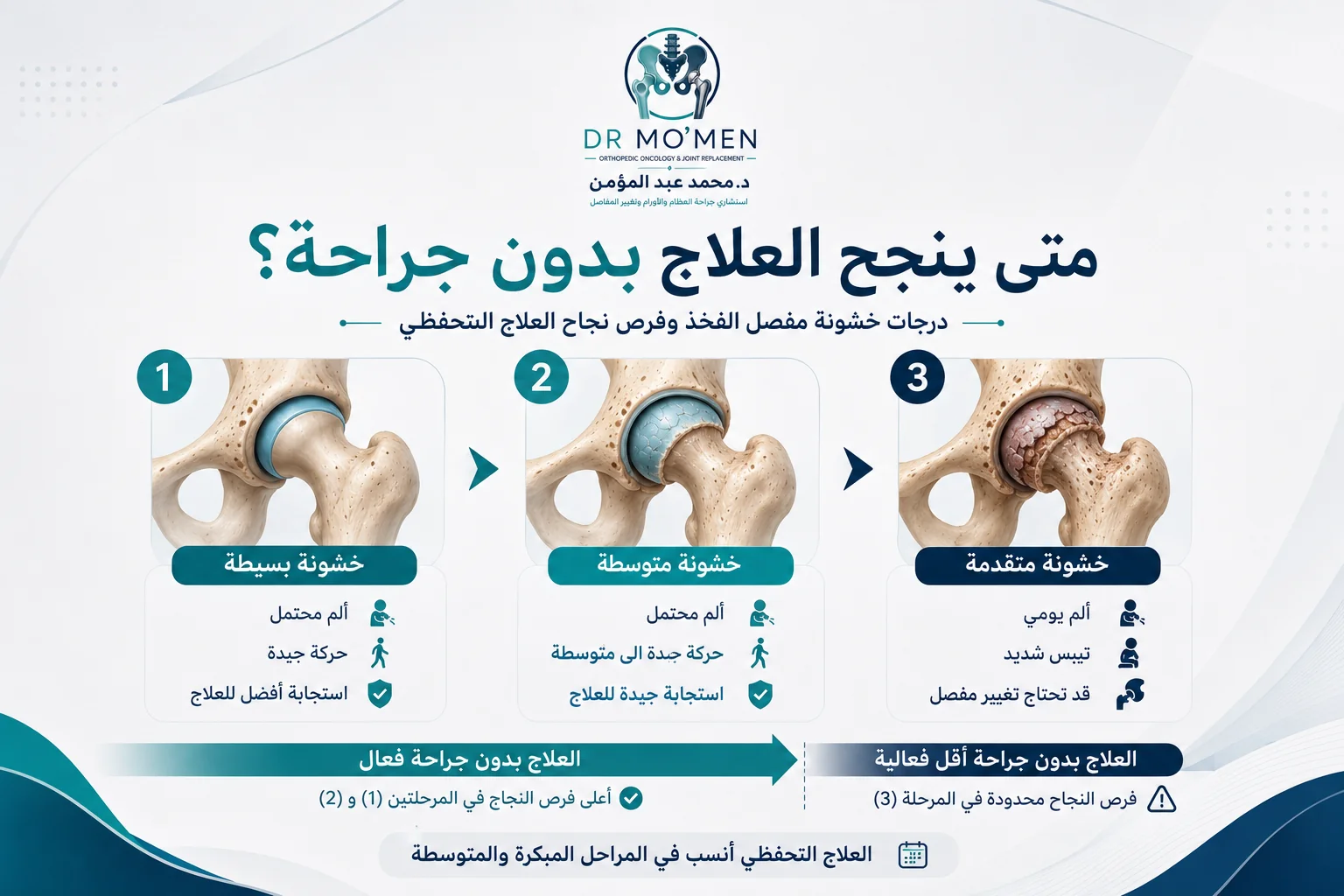 درجات خشونة مفصل الفخذ ومتى ينجح العلاج بدون جراحة