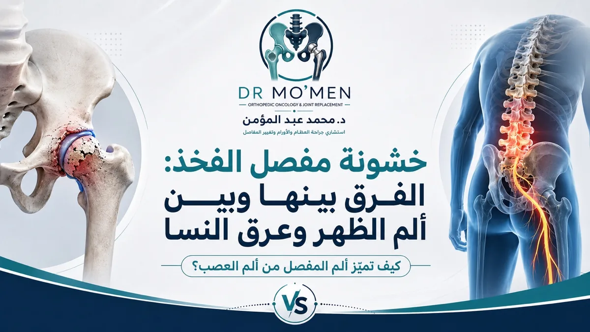 خشونة مفصل الفخذ والفرق بينها وبين ألم الظهر وعرق النسا