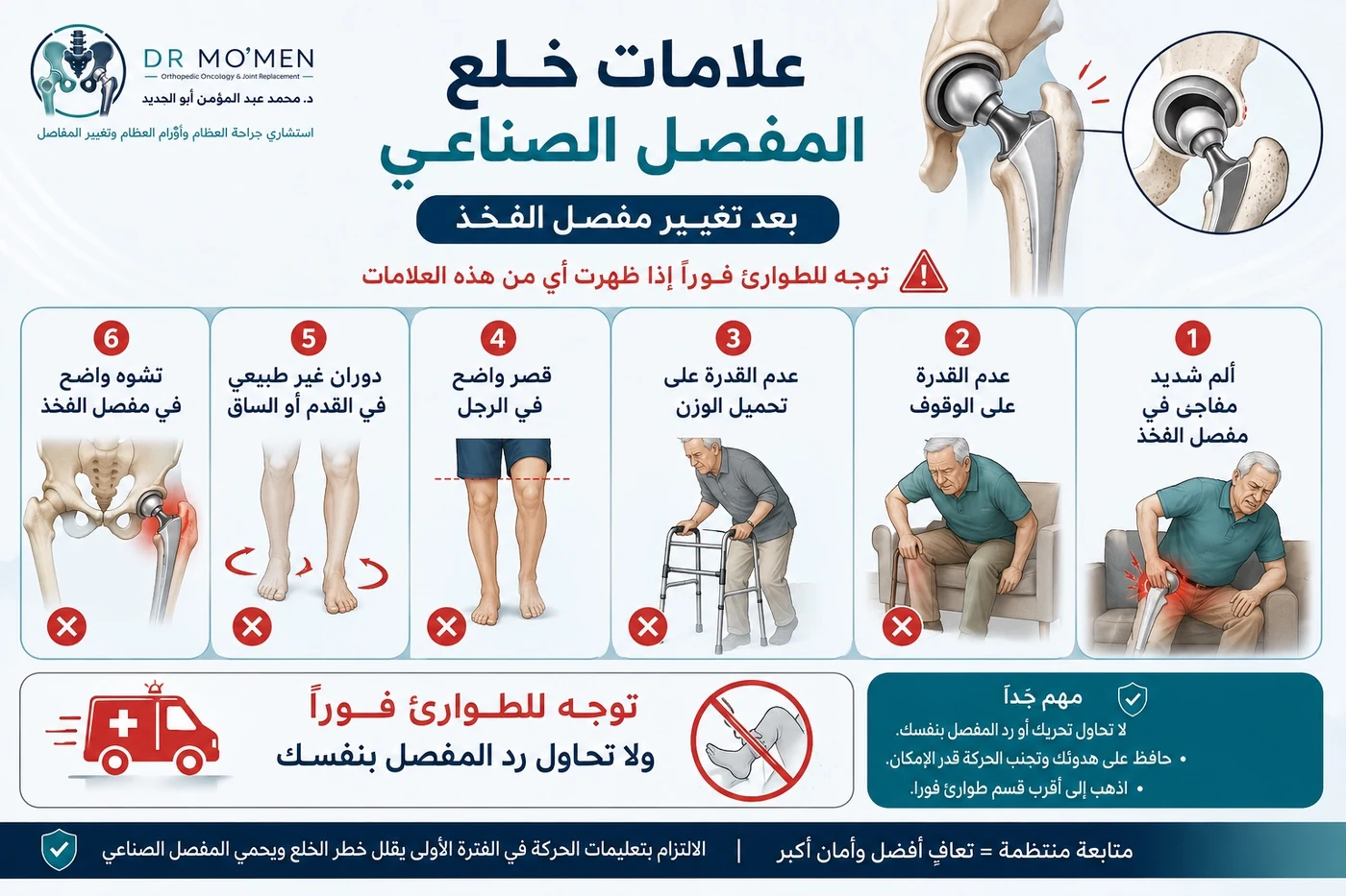 علامات خلع مفصل الفخذ الصناعي بعد العملية ومتى تتوجه للطوارئ
