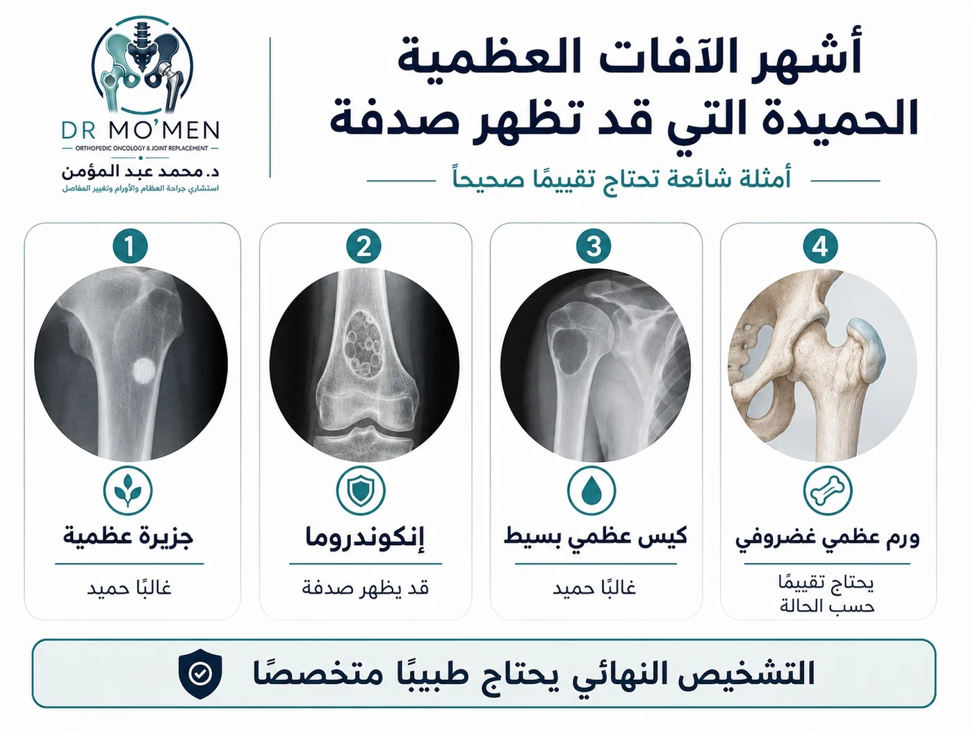أمثلة لآفات عظمية قد تظهر صدفة مثل Bone island وEnchondroma وSimple bone cyst وOsteochondroma