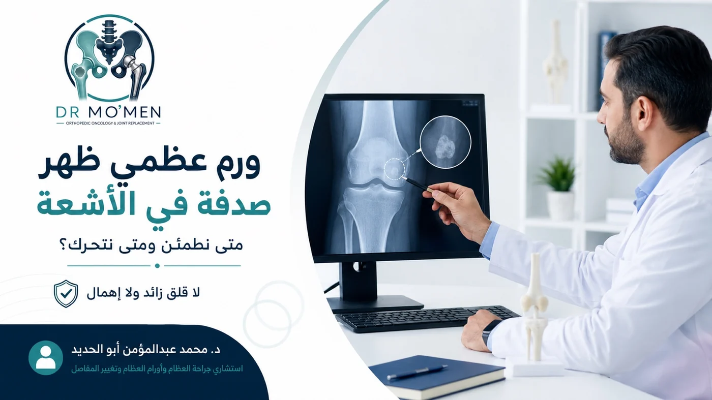 ورم عظمي ظهر صدفة في الأشعة ومتى نحتاج متابعة أو رنين أو تقييم متخصص