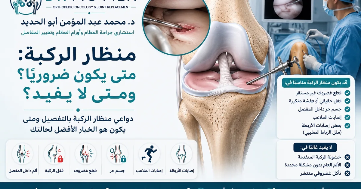 منظار الركبة متى يكون ضروريًا ومتى لا يفيد في علاج قطع الغضروف وخشونة الركبة