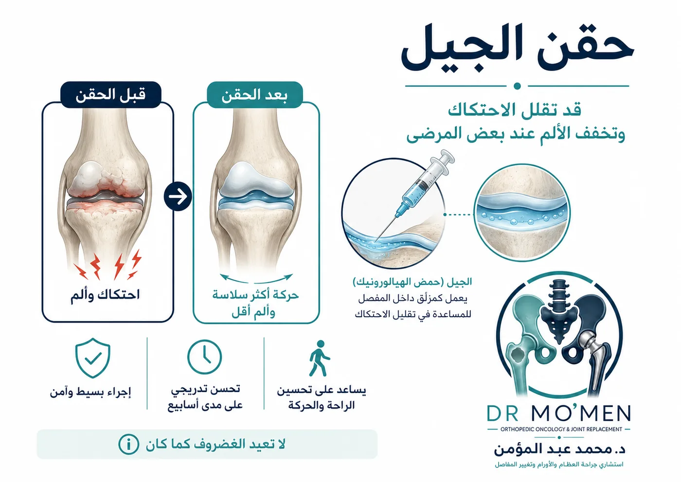 حقن الجيل للركبة أو حمض الهيالورونيك في خشونة الركبة