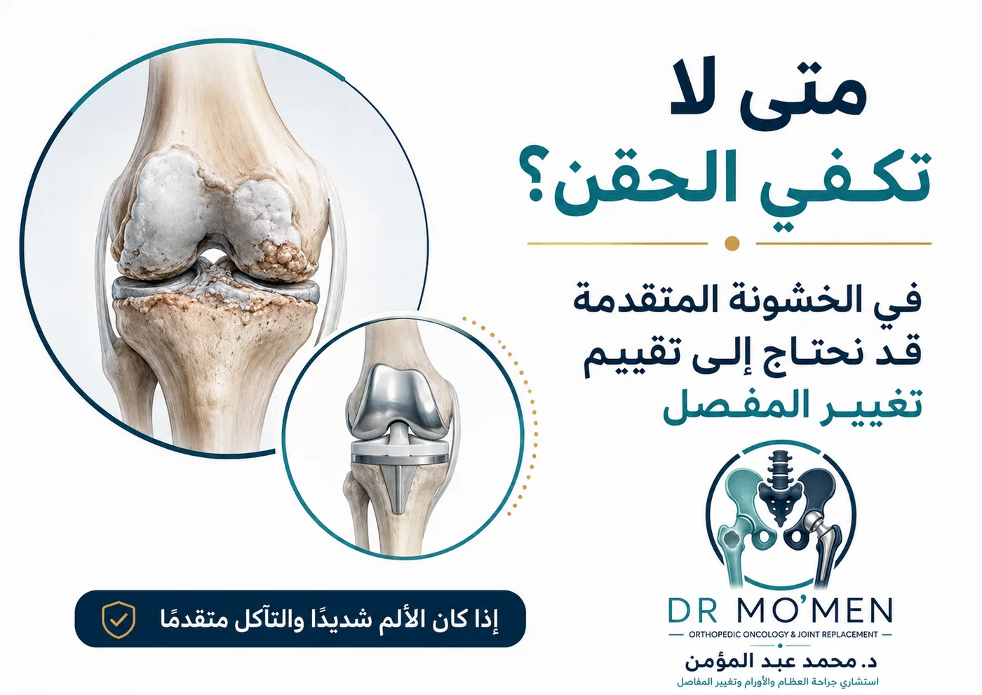 متى لا تكفي حقن الركبة ونحتاج تقييم تغيير المفصل