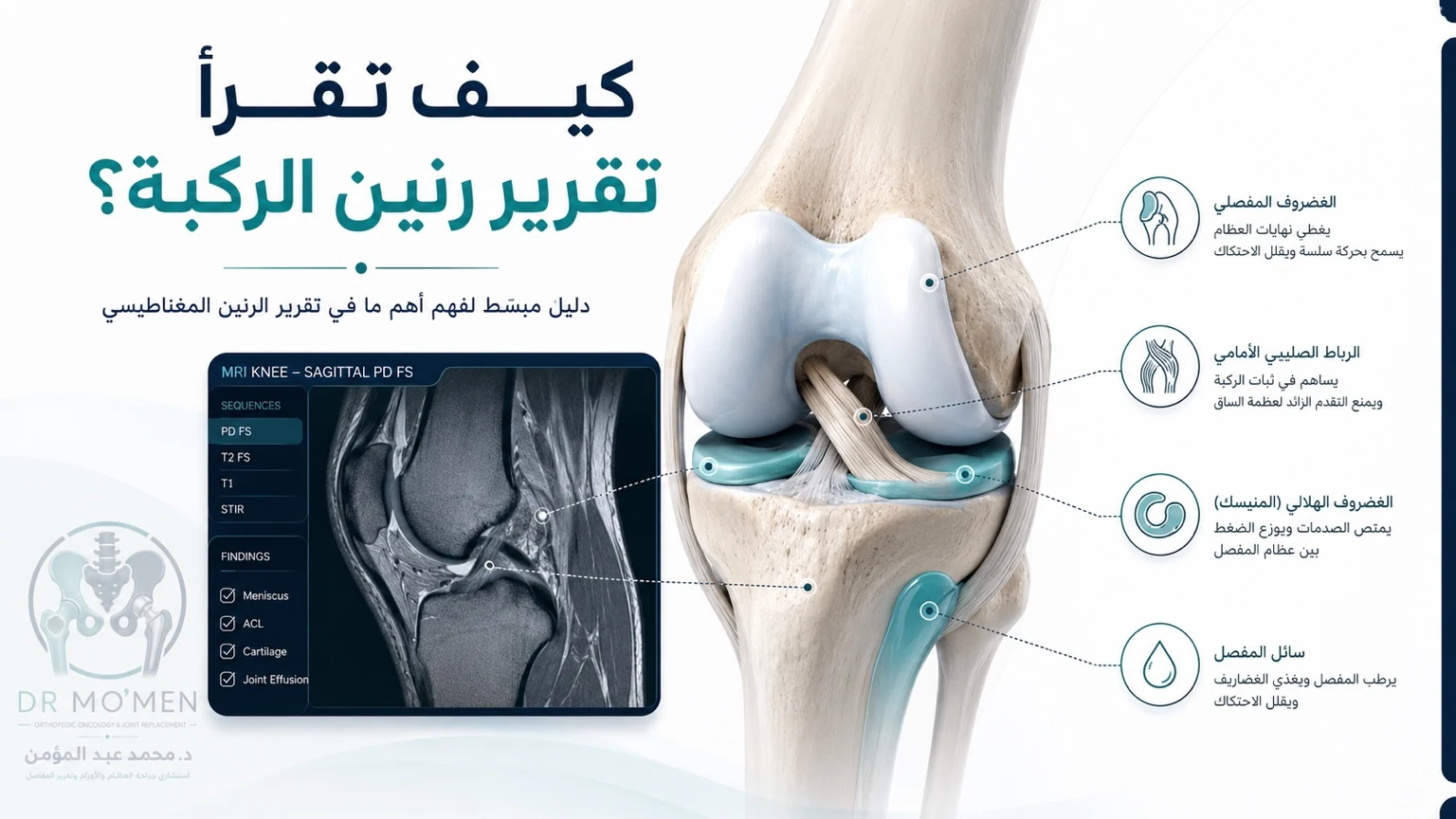 كيف تقرأ تقرير رنين الركبة وشرح الغضروف الهلالي والرباط الصليبي